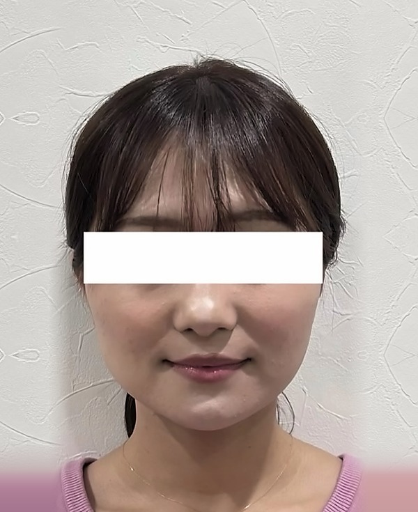 施術前